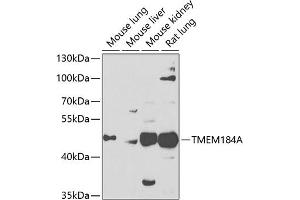 Western blot analysis of extracts of various cell lines, using TMEM184A antibody (ABIN6128873, ABIN6149260, ABIN6149261 and ABIN6223833) at 1:1000 dilution. (TMEM184A 抗体  (AA 324-413))