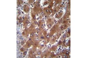 Immunohistochemistry analysis in formalin fixed and paraffin embedded human liver tissue reacted with Cytosolic beta-glucosidase Antibody (C-term) followed by peroxidase conjugation of the secondary antibody and DAB staining. (GBA3 抗体  (C-Term))