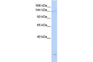 WB Suggested Anti-SMC4 Antibody Titration:  0. (SMC4 抗体  (N-Term))