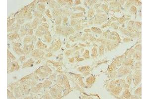 Immunohistochemistry of paraffin-embedded human heart tissue using ABIN7169200 at dilution of 1:100 (TNNI3K 抗体  (AA 1-75))