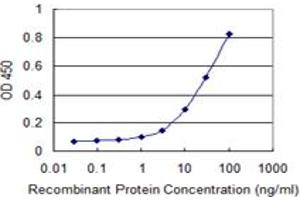 Detection limit for recombinant GST tagged TAGLN is 0. (Transgelin 抗体  (AA 1-201))