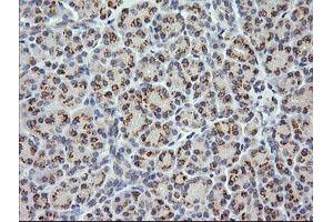 Image no. 1 for anti-Cancer/testis Antigen 1B (CTAG1B) antibody (ABIN1499891) (CTAG1B 抗体)