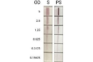 Test lines composed of streptavidin and polymerized streptavidin were applied to nitrocellulose membranes at a concentration of 2 mg/mL in PBS and evaluated under identical assay conditions. (Polystreptavidin 蛋白)