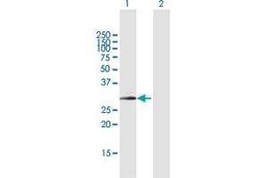 Western Blot analysis of SPINT2 expression in transfected 293T cell line by SPINT2 MaxPab polyclonal antibody. (SPINT2 抗体  (AA 1-252))