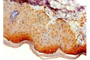 Immunohistochemistry of paraffin-embedded human skin tissue using ABIN7145338 at dilution of 1:100