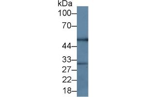 Western Blotting (WB) image for Tumor Necrosis Factor (Ligand) Superfamily, Member 11 (TNFSF11) ELISA Kit (ABIN6574228)