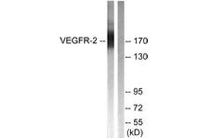 Western blot analysis of extracts from HepG2 cells, treated with Na3VO4 0. (VEGFR2/CD309 抗体  (AA 1025-1074))