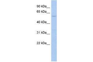 WB Suggested Anti-PTPN5 Antibody Titration:  0. (PTPN5 抗体  (Middle Region))