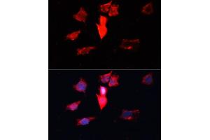 Immunofluorescence analysis of HeLa cells using C antibody (ABIN3021589, ABIN3021590, ABIN3021591 and ABIN6215299) at dilution of 1:100. (Calmodulin 3 抗体  (AA 1-100))