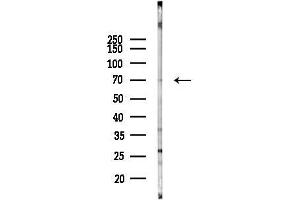 anti-WD Repeat Domain 76 (WDR76) antibody