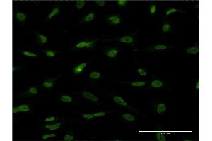 Immunofluorescence of monoclonal antibody to EPAS1 on HeLa cell. (EPAS1 抗体  (AA 28-347))