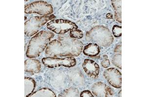 Immunohistochemical staining (Formalin-fixed paraffin-embedded sections) of human kidney with CA12 monoclonal antibody, clone CL0278  shows strong membranous immunoreactivity in renal tubules, but not glomeruli. (CA12 抗体)