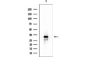 Western blot analysis of lysates from EC304 cells, using SSBP2 Antibody at 1/1000 dilution.