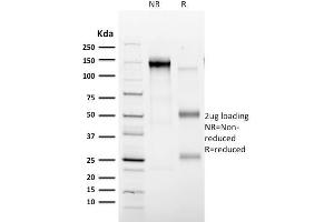 SDS-PAGE Analysis Purified CD35 Mouse Monoclonal Antibody (E11). (CD35 抗体)