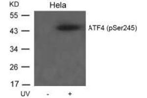 Western blot analysis of extracts from Hela cells untreated or treated with UV using ATF4(Phospho-Ser245) Antibody. (ATF4 抗体  (pSer245))