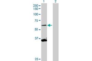 Western Blot analysis of SCMH1 expression in transfected 293T cell line by SCMH1 MaxPab polyclonal antibody. (SCMH1 抗体  (AA 1-660))
