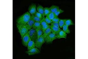 anti-UPF2 Regulator of Nonsense Transcripts 2 (UPF2) (AA 200-651) antibody