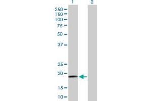 Western Blot analysis of RPS19 expression in transfected 293T cell line by RPS19 MaxPab polyclonal antibody. (RPS19 抗体  (AA 1-145))
