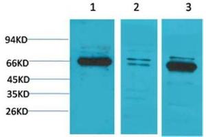 Western Blot (WB) analysis of 1) PC3, 2)Mouse Brain Tissue, 3) Rat Brain Tissue with Bestrophin-1 Rabbit Polyclonal Antibody diluted at 1:2000.