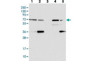 Western blot analysis of Lane 1: RT-4, Lane 2: U-251 MG, Lane 3: Human Plasma, Lane 4: Liver, Lane 5: Tonsil with ZNF609 polyclonal antibody  at 1:100-1:250 dilution. (ZNF609 抗体)