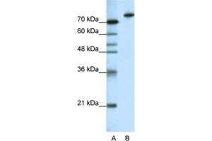 Western Blotting (WB) image for anti-Kelch-Like 3 (KLHL3) antibody (ABIN2461880) (KLHL3 抗体)
