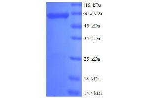 SDS-PAGE (SDS) image for Plasminogen Activator Inhibitor 2 (SERPINB2) (AA 1-416), (full length) protein (His-SUMO Tag) (ABIN5710340) (SERPINB2 Protein (AA 1-416, full length) (His-SUMO Tag))