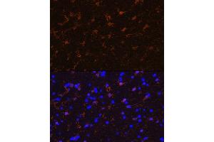 Immunofluorescence (IF) image for anti-S100 Calcium Binding Protein B (S100B) antibody (ABIN7270131)