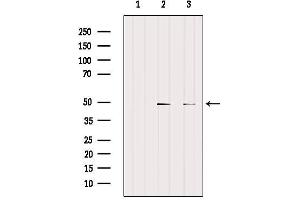 Western blot analysis of extracts from various samples, using CCRN4L Antibody.
