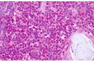 Image no. 2 for anti-Transcription Factor 4 (TCF4) (N-Term) antibody (ABIN6749785) (TCF4 抗体  (N-Term))