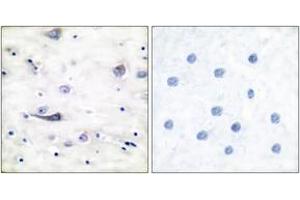 Immunohistochemistry analysis of paraffin-embedded human brain, using GluR1 (Phospho-Ser863) Antibody. (Glutamate Receptor 1 抗体  (pSer863))