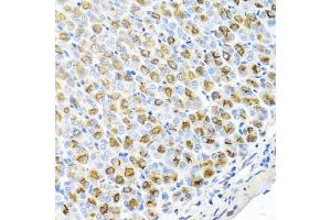 Immunohistochemistry (IHC) image for anti-Ferrochelatase (FECH) (AA 1-200) antibody (ABIN6140573)