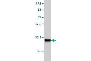 Western Blotting (WB) image for anti-Homeobox D8 (HOXD8) (AA 126-190) antibody (ABIN561347)