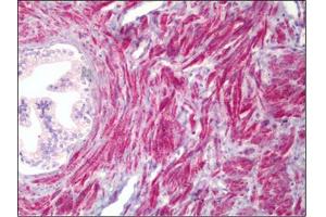Human Prostate, Smooth Muscle: Formalin-Fixed, Paraffin-Embedded (FFPE) (PMEPA1 抗体)
