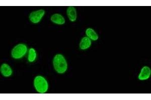 Immunofluorescence staining of MCF-7 cells with ABIN7139594 at 1:5, counter-stained with DAPI. (HIST1H1C 抗体  (meLys186))