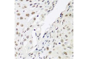 Immunohistochemistry (Paraffin-embedded Sections) (IHC (p)) image for anti-Chromobox Homolog 3 (CBX3) (AA 1-183) antibody (ABIN1512681)