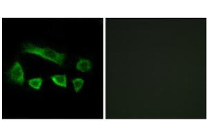 Immunofluorescence analysis of A549 cells, using NT5C1B antibody. (NT5C1B 抗体  (Internal Region))