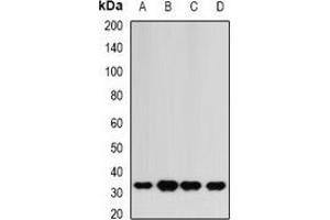 Western blot analysis of HAGH expression in HepG2 (A), mouse liver (B), mouse heart (C), rat kidney (D) whole cell lysates. (HAGH 抗体)