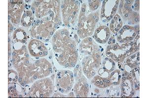 Immunohistochemical staining of paraffin-embedded liver tissue using anti-SERPINA1mouse monoclonal antibody. (SERPINA1 抗体)