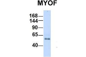 Host:  Rabbit  Target Name:  MYOF  Sample Type:  Human Fetal Heart  Antibody Dilution:  1. (Myoferlin 抗体  (C-Term))