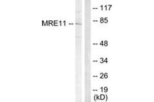 Western blot analysis of extracts from Jurkat cells, treated with UV 15', using MRE11 (Ab-264) Antibody. (Mre11 抗体  (AA 230-279))