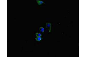 Immunofluorescent analysis of HepG2 cells using ABIN7169164 at dilution of 1:100 and Alexa Fluor 488-congugated AffiniPure Goat Anti-Rabbit IgG(H+L) (ACVRL1 抗体  (AA 22-118))