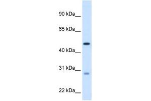 Western Blotting (WB) image for anti-Enoyl CoA Hydratase, Short Chain, 1, Mitochondrial (ECHS1) (C-Term) antibody (ABIN629680)