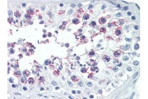 Human Testis (formalin-fixed, paraffin-embedded) stained with SMURF1followed by biotinylated goat anti-rabbit IgG secondary antibody, alkaline phosphatase-streptavidin and chromogen. (SMURF1 抗体  (N-Term))