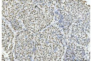 IHC analysis of Cyclophilin E/PPIE using anti-Cyclophilin E/PPIE antibody (ABIN7599242). (PPIE 抗体  (AA 1-301))