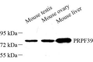Western blot analysis of PRPF39 (ABIN7075170) at dilution of 1: 500 (PRPF39 抗体)