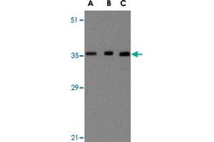 Western blot analysis of BRCC3 in MCF-7 cell lysate with BRCC3 polyclonal antibody  at (A) 0. (BRCC3 抗体  (N-Term))