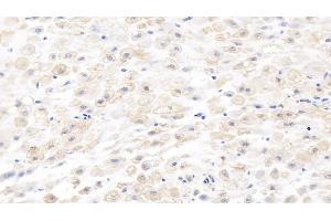 Detection of MMP8 in Human Placenta Tissue using Monoclonal Antibody to Matrix Metalloproteinase 8 (MMP8) (MMP8 抗体  (AA 101-467))