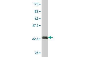 Western Blotting (WB) image for anti-Kv Channel Interacting Protein 2 (KCNIP2) (AA 1-100) antibody (ABIN565469)
