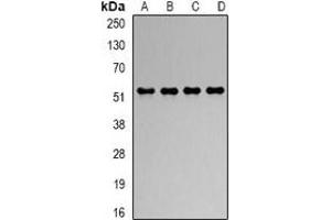 Western blot analysis of RbAp48 expression in Hela (A), Jurkat (B), NIH3T3 (C), COS7 (D) whole cell lysates. (Retinoblastoma Binding Protein 4 抗体)