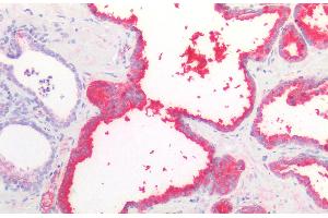 Immunohistochemistry staining of human prostate (paraffin-embedded sections) with anti-PSA (A67-B/E3), 10 μg/mL. (Prostate Specific Antigen 抗体)
